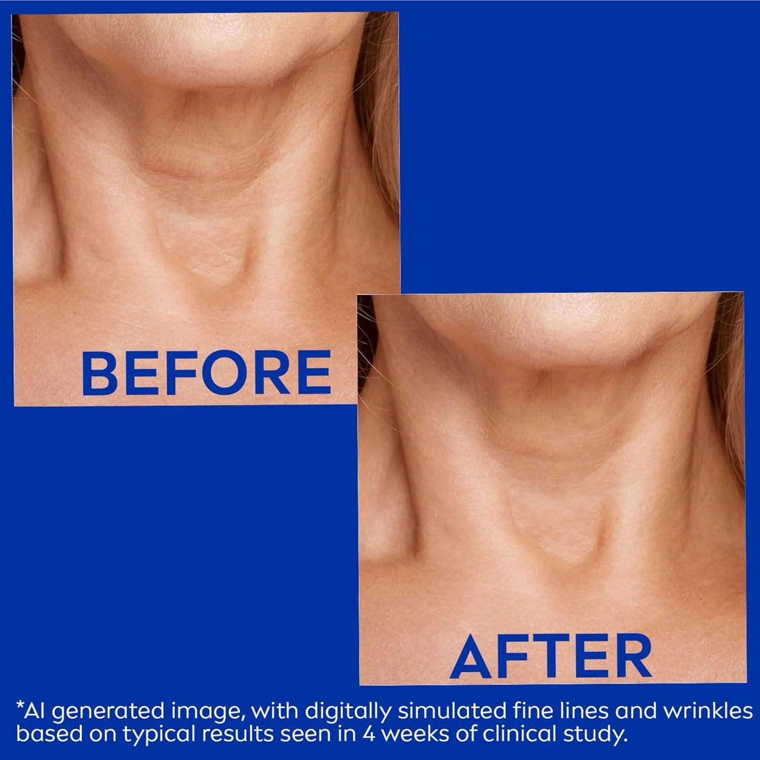 Juxek Neck Firming Cream Reduces Wrinkles and Double Chin,Five Rollers for All Around Massage